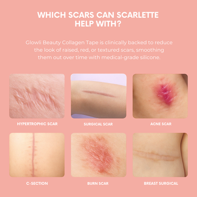 Glowli Silicone Collagen Sheets for Scars & Wrinkles