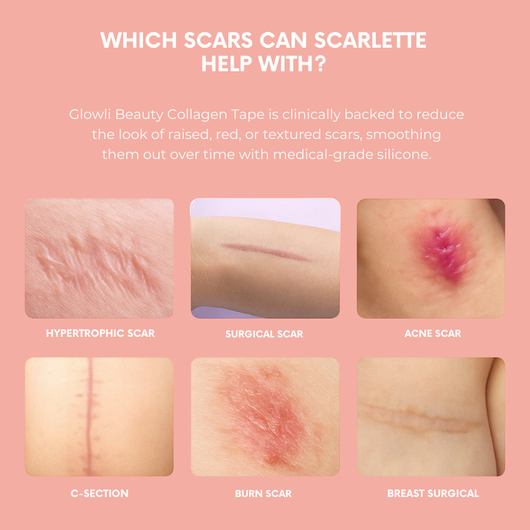 Glowli Silicone Collagen Sheets for Scars & Wrinkles