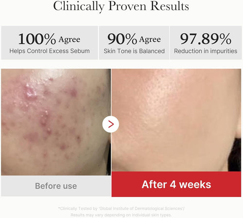 Red Succinic Acid + Panthenol Exfoliating Toner Pads