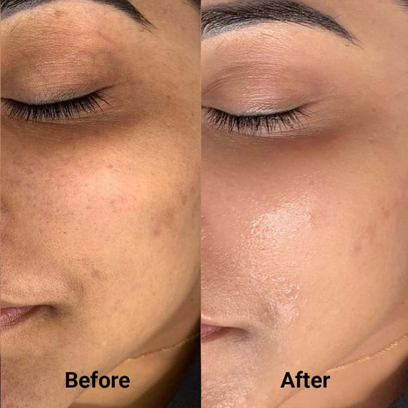 Feature product image