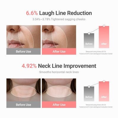 Korean PDRN Collagen Wrinkle Stick