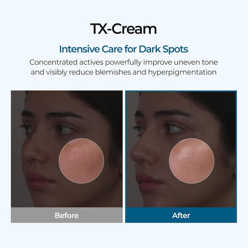 TX Tranexamic Acid Cream for Hyperpigmentation & Freckles corrector
