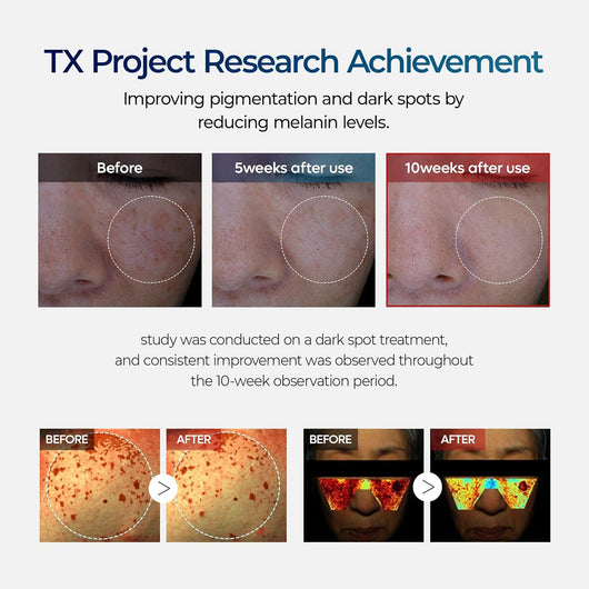 TX Tranexamic Acid Cream for Hyperpigmentation & Freckles corrector