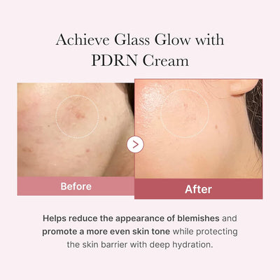 PDRN Pink Hyaluronic Moisturizing Cream