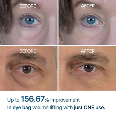 Korean Eyephalt Eyebag Cream