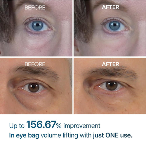 Korean Eyephalt Eyebag Cream