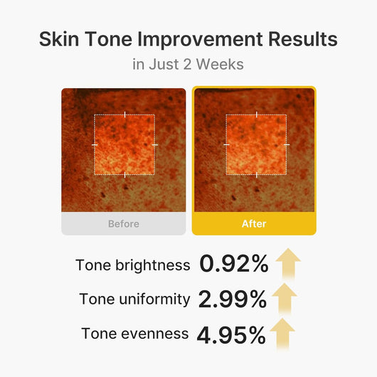 Kojic Acid Turmeric Vita Capsule Cream