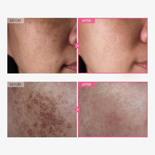 Korean Arbutin + Tranexamic Brightening Cream