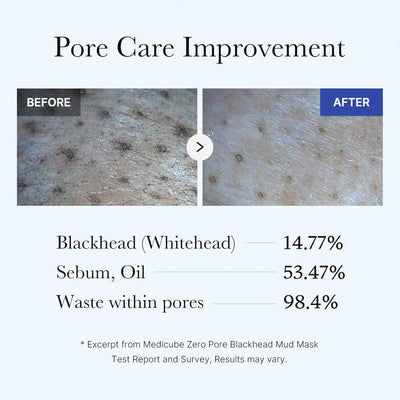 Zero Pore Blackhead Mud Wrapping Mask
