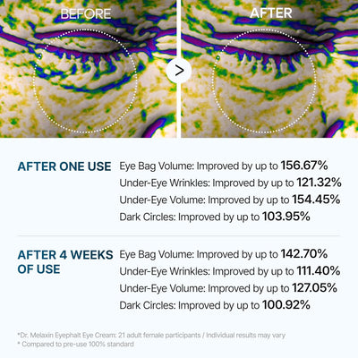 Korean Eyephalt Eyebag Cream