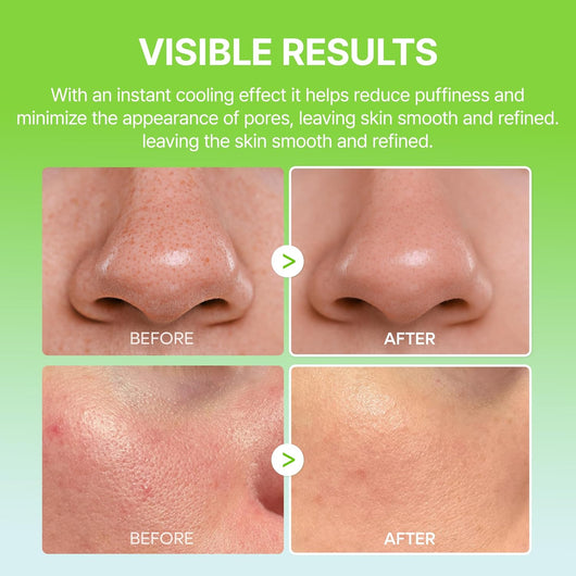 Cooling Pore Relief Balm Stick – De-Puffs, Tightens Pores & Smooths Skin