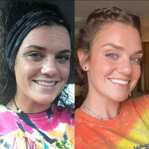 Glowli Silicone Collagen Sheets for Scars & Wrinkles